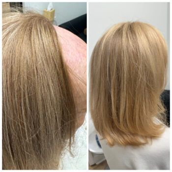 Before & after blonde hair extensions.